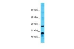 MS4A6E Rabbit anti-Human, Polyclonal, Novus Biologicals 100 &mu;g | Buy Online | Novus Biologicals | Fisher Scientific